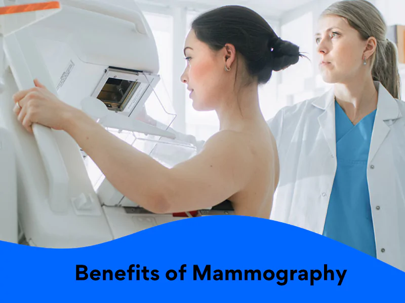 mammography