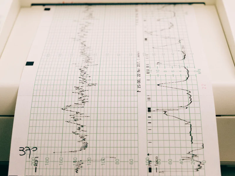 remote patient monitoring devices