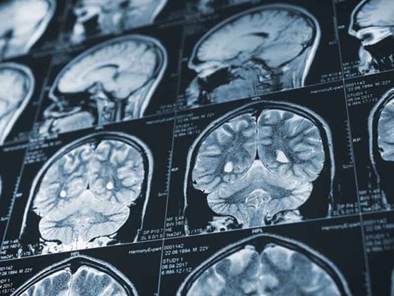 How Do I Prepare for a CT Scan?